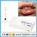 Hyaluronate Acid Lip Injection Dermal Filler Lip Fullness Lip Augmentation